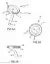 Fig. 04 - Steerable and shapable catheter employing fluid force