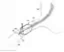 Fig. 01 - Balloon catheter with perfusion lumen