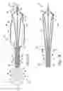 Fig. 02 - Balloon catheter with perfusion lumen