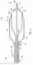 Fig. 04 - Balloon catheter with perfusion lumen