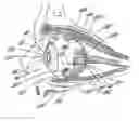 Fig. 01 - Implantable delivery device for administering pharmacological agents to an internal portion of a body