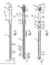 Fig. 04 - Surgical drains