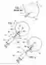 Fig. 02 - Apparatus and methods useful for intravitreal injection of drugs