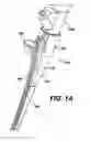 Fig. 03 - Feeding tube