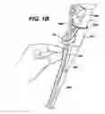 Fig. 04 - Feeding tube