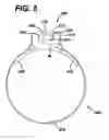 Fig. 09 - Feeding tube
