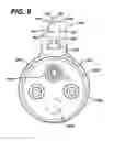 Fig. 12 - Feeding tube