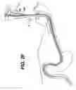 Fig. 19 - Feeding tube