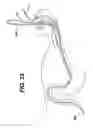 Fig. 22 - Feeding tube