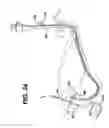 Fig. 33 - Feeding tube