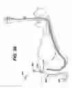 Fig. 35 - Feeding tube