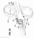 Fig. 45 - Feeding tube