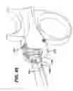 Fig. 46 - Feeding tube