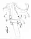 Fig. 47 - Feeding tube