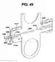 Fig. 49 - Feeding tube