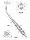 Fig. 04 - Aspirator sleeve and suction handle