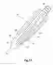 Fig. 12 - Aspirator sleeve and suction handle