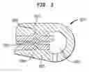 Fig. 04 - Implantable pump with infinitely variable resistor