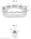 Fig. 09 - Implantable pump with infinitely variable resistor