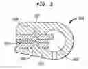 Fig. 04 - Reduced size implantable pump
