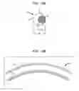 Fig. 11 - Reduced size implantable pump