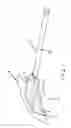 Fig. 02 - Bacteria resistant coating for surgical instrument