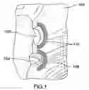 Fig. 02 - ELECTROSURGICAL TREATMENT METHOD AND DEVICE