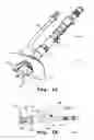 Fig. 02 - Cavity ablation apparatus and method