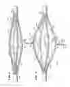 Fig. 07 - Method for vacuum-assisted tissue ablation