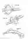 Fig. 28 - Method for vacuum-assisted tissue ablation