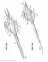 Fig. 30 - Method for vacuum-assisted tissue ablation