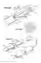 Fig. 32 - Method for vacuum-assisted tissue ablation