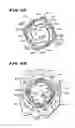 Fig. 33 - Method for vacuum-assisted tissue ablation