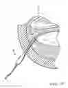 Fig. 23 - Electrosurgical ablation electrode with aspiration and method for using same