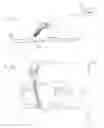 Fig. 09 - Method and Apparatus for Performing a Surgical Procedure