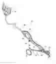 Fig. 01 - Vessel sealing forceps with disposable electrodes