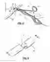 Fig. 07 - Vessel sealing forceps with disposable electrodes