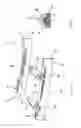 Fig. 03 - Intervertebral implant