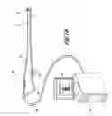 Fig. 03 - Endoscopic apparatus with integrated variceal ligation device