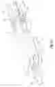 Fig. 04 - Endoscopic apparatus with integrated variceal ligation device