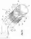 Fig. 06 - Endoscopic apparatus with integrated variceal ligation device