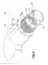 Fig. 11 - Endoscopic apparatus with integrated variceal ligation device