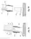 Fig. 12 - Endoscopic apparatus with integrated variceal ligation device