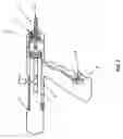 Fig. 03 - Device for multi-ligation of hemorrhoids