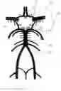 Fig. 19 - Neuro thrombectomy catheter