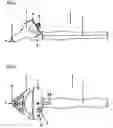 Fig. 02 - Automated ophthalmic device for performance of capsulorhexis
