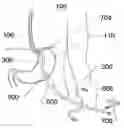 Fig. 01 - Expandable sheath for percutaneous upper gastrointestinal tract access