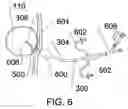 Fig. 07 - Expandable sheath for percutaneous upper gastrointestinal tract access