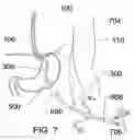 Fig. 08 - Expandable sheath for percutaneous upper gastrointestinal tract access