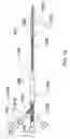 Fig. 14 - Expandable sheath for percutaneous upper gastrointestinal tract access